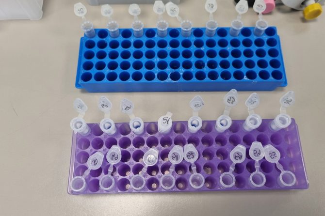 Pacientul cu Hantavirus a fost diagnosticat cu tulpinile existente în România! Nu se transmit de la om la om!