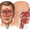 Când ne prezentăm la medicul specialist otorinolaringolog – ORL?