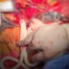 Intervenție deosebit de dificilă, finalizată cu succes de către o echipă de medici din Secția Clinică Chirurgie Generală I!