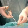 Intervenție salvatoare pentru o tânără mamă de 29 de ani